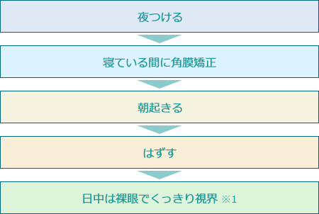 近視矯正の仕組み